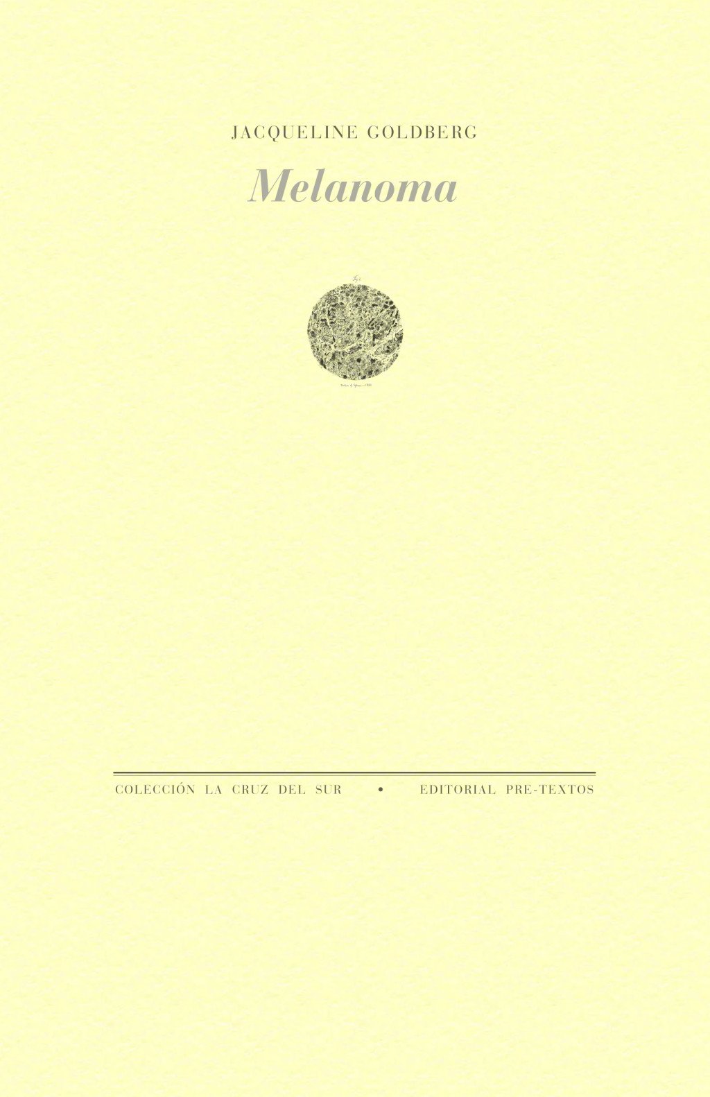 Melanoma